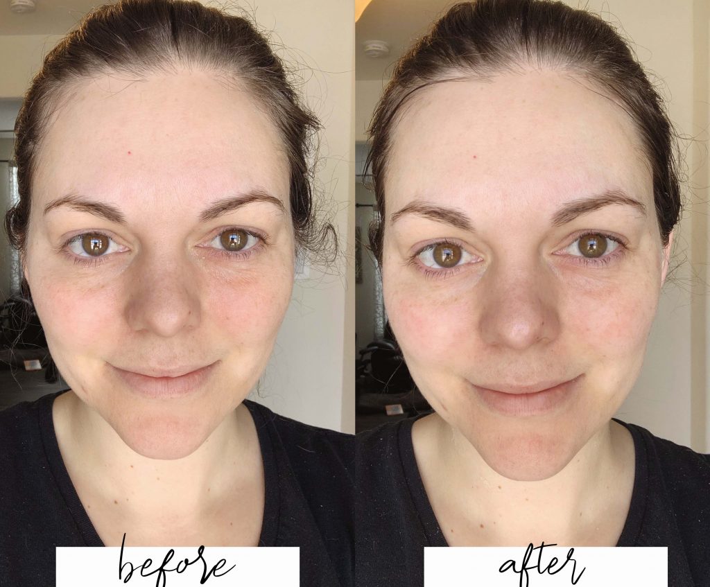 Before and after using the L'Bri Facial Masque, a Hanacure Mask dupe.